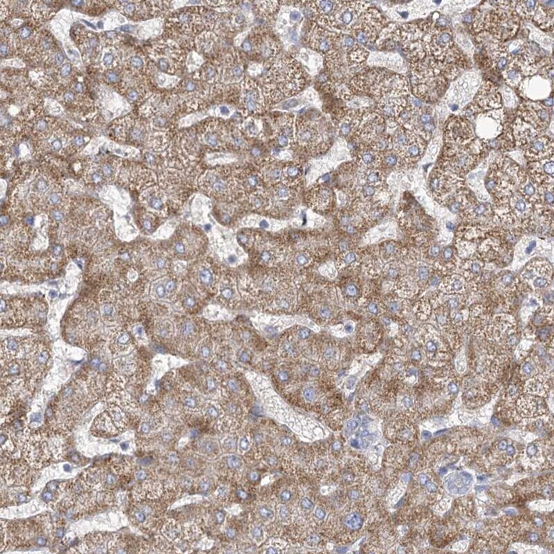 FAM82A Antibody - BSA Free Immunohistochemistry-Paraffin: FAM82A Antibody - BSA Free [NBP1-87934]