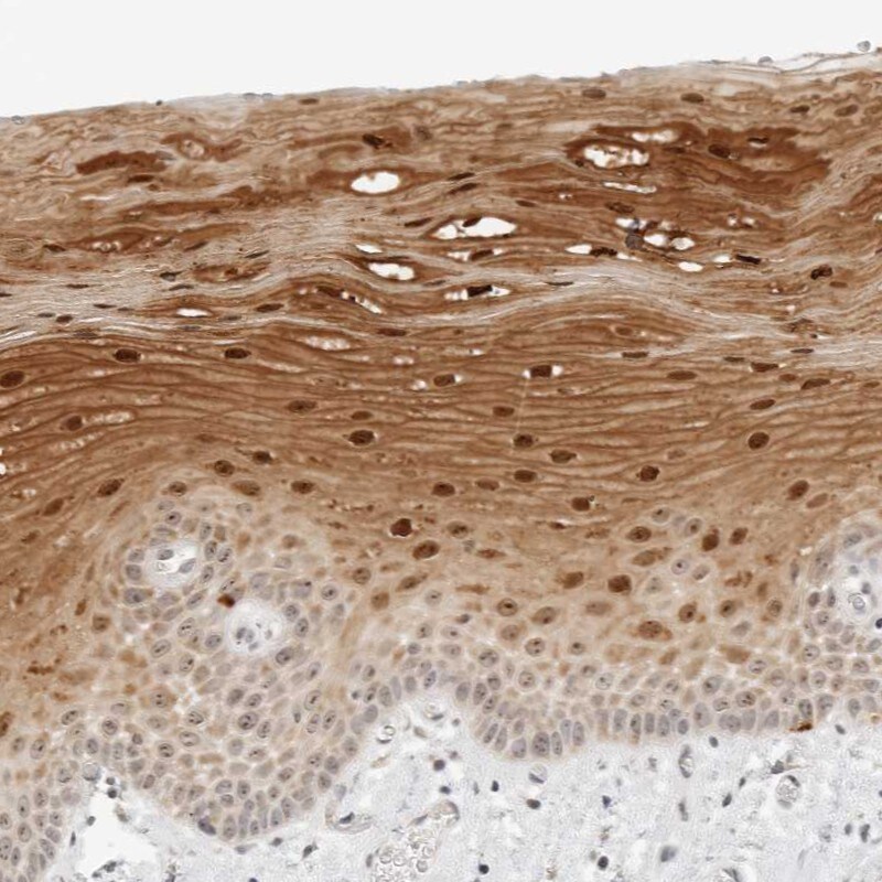 FAM80A Antibody - BSA Free Immunohistochemistry-Paraffin: FAM80A Antibody - BSA Free [NBP1-87935]