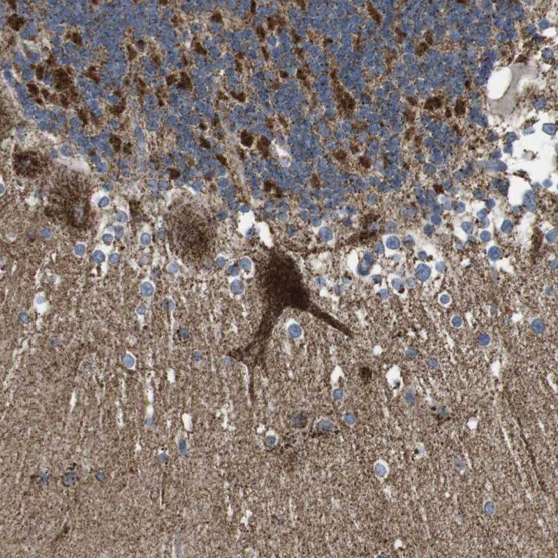 calcium homeostasis modulator 2 Antibody - BSA Free Immunohistochemistry-Paraffin: calcium homeostasis modulator 2 Antibody - BSA Free [NBP1-87936]