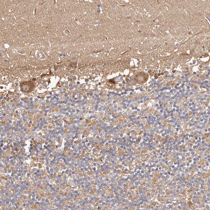 ERK2 Antibody - BSA Free Immunohistochemistry-Paraffin: ERK2 Antibody [NBP1-87943]