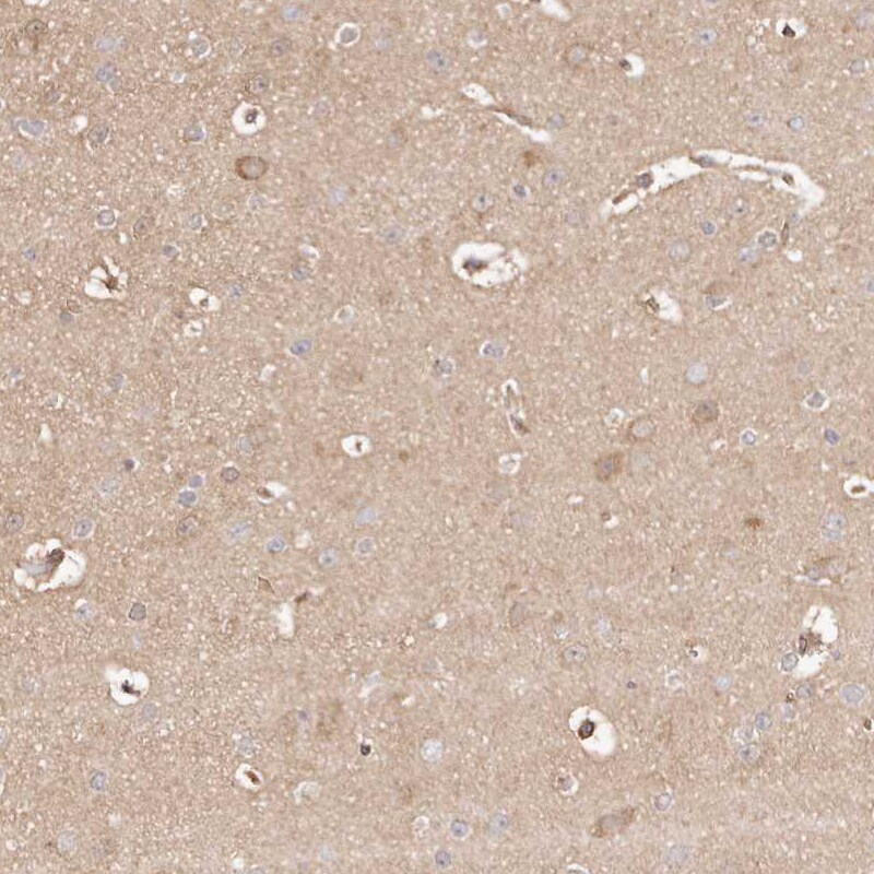 ERK2 Antibody - BSA Free Immunohistochemistry-Paraffin: ERK2 Antibody [NBP1-87943]