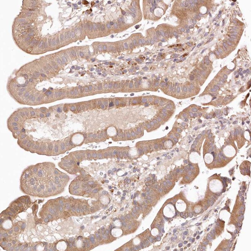 ERK2 Antibody - BSA Free Immunohistochemistry-Paraffin: ERK2 Antibody [NBP1-87943]
