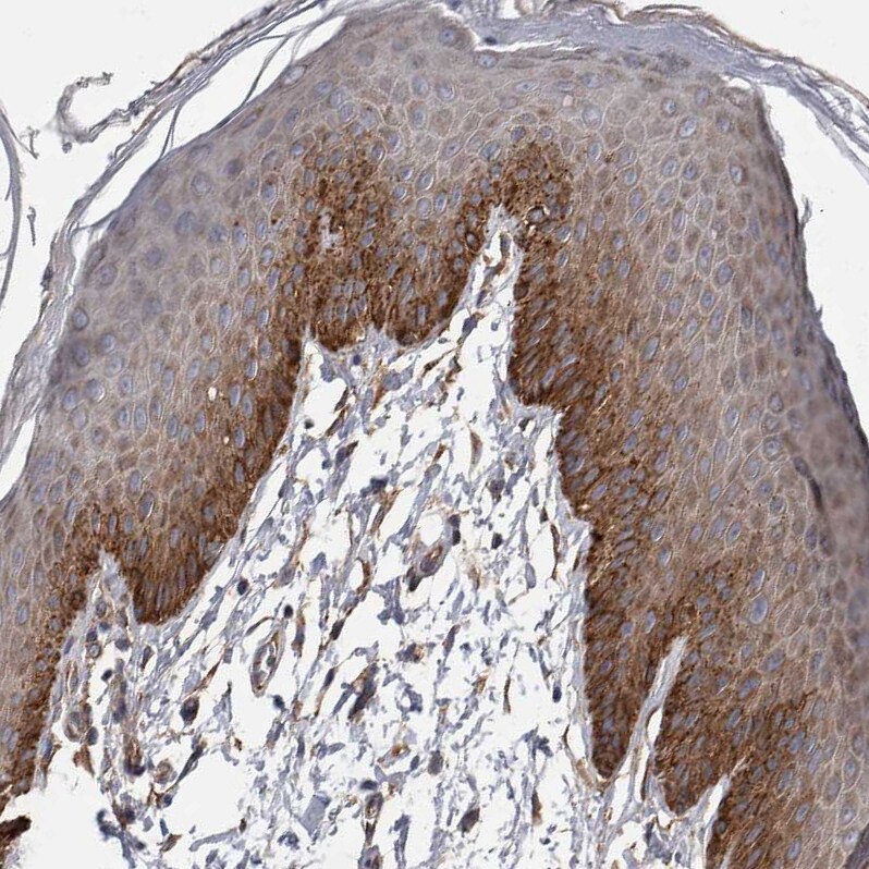 EPLIN Antibody - BSA Free Immunohistochemistry-Paraffin: EPLIN Antibody - BSA Free [NBP1-87947]
