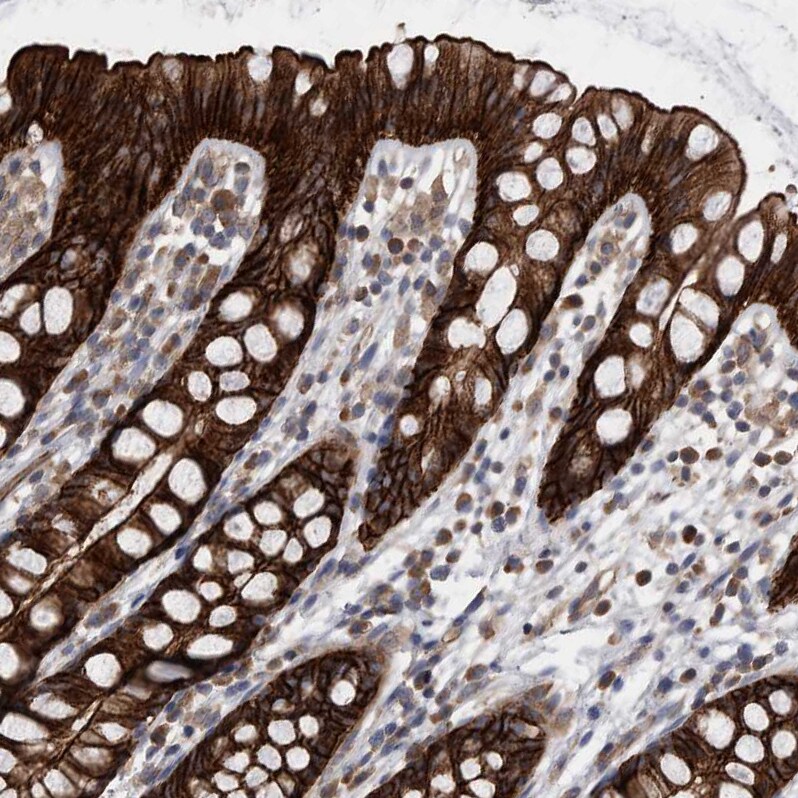 EPLIN Antibody - BSA Free Immunohistochemistry-Paraffin: EPLIN Antibody - BSA Free [NBP1-87947]