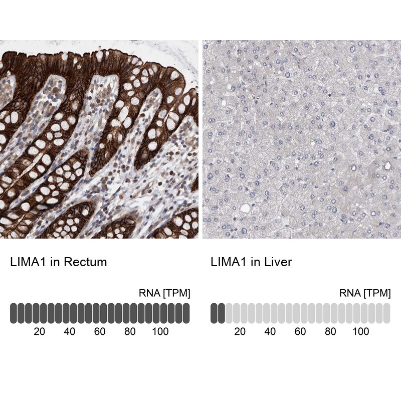 EPLIN Antibody - BSA Free Immunohistochemistry-Paraffin: EPLIN Antibody - BSA Free [NBP1-87947]