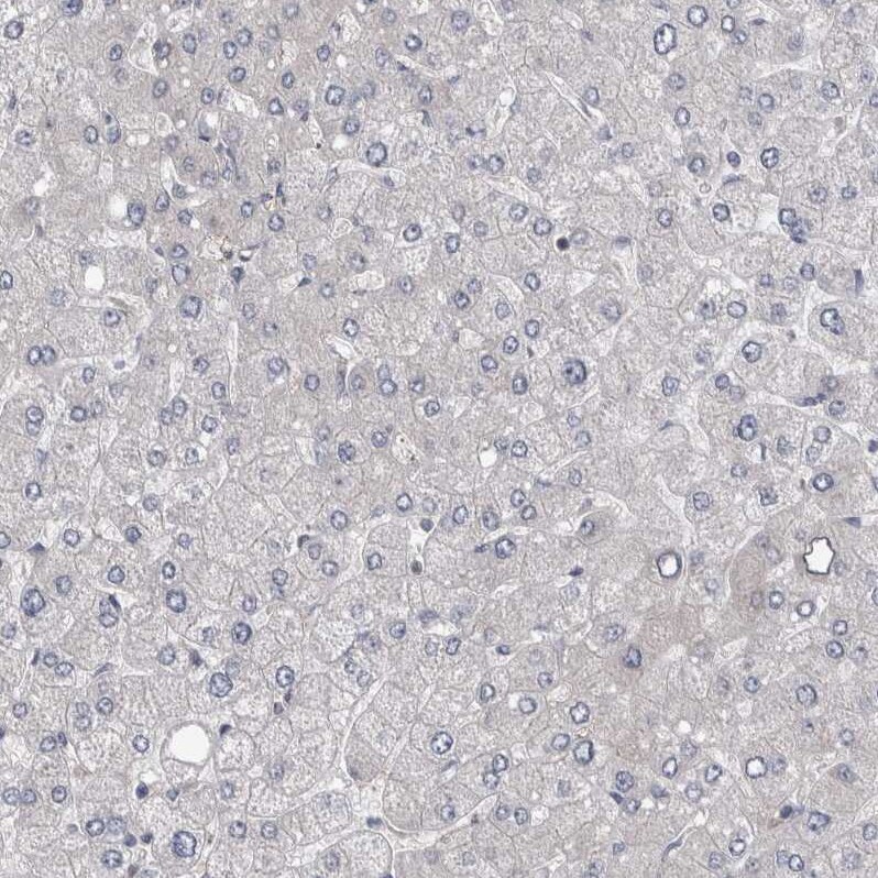 EPLIN Antibody - BSA Free Immunohistochemistry-Paraffin: EPLIN Antibody - BSA Free [NBP1-87947]