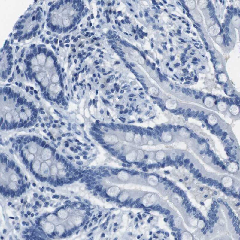 Enteropeptidase/Enterokinase Antibody - BSA Free Immunohistochemistry-Paraffin: Enteropeptidase/Enterokinase Antibody [NBP1-87949]
