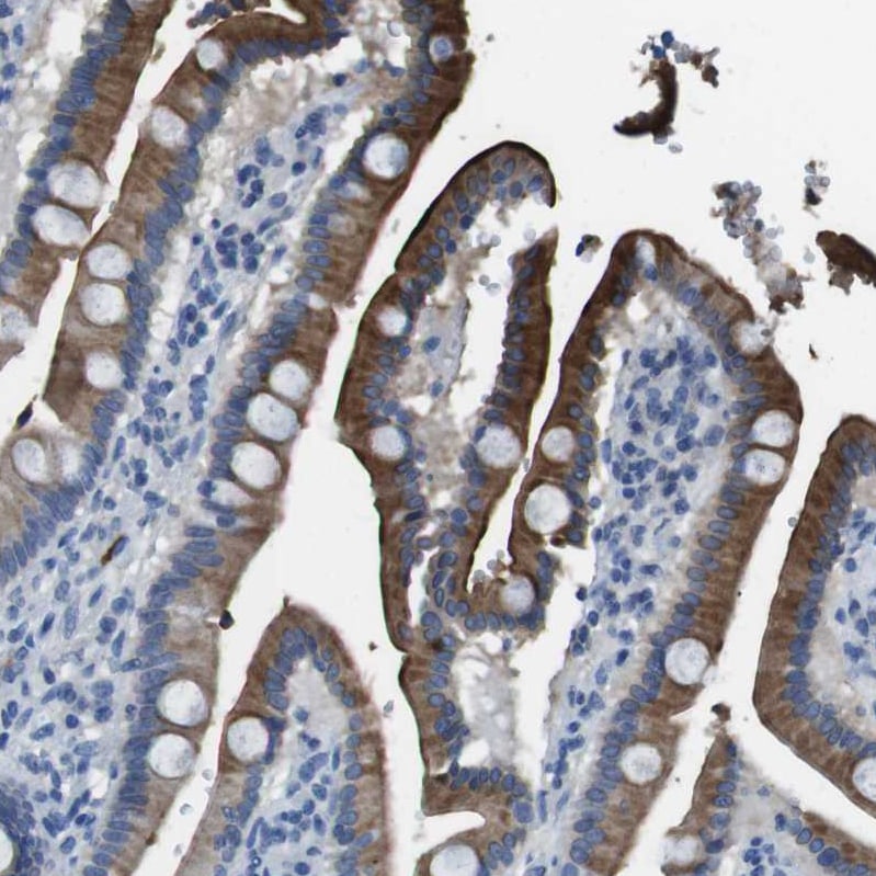 Enteropeptidase/Enterokinase Antibody - BSA Free Immunohistochemistry-Paraffin: Enteropeptidase/Enterokinase Antibody [NBP1-87949]