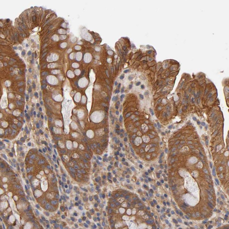 ROBLD3 Antibody - BSA Free Immunohistochemistry-Paraffin: ROBLD3 Antibody - BSA Free [NBP1-87951]
