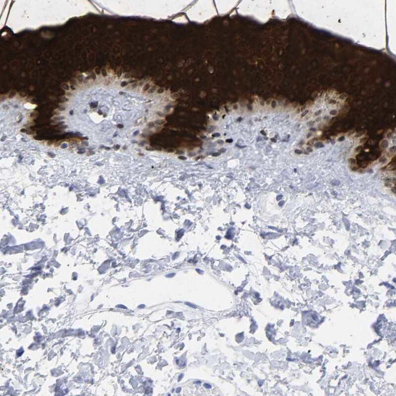 Cytokeratin 1 Antibody - BSA Free Immunohistochemistry: Cytokeratin 1 Antibody - BSA Free [NBP1-87956]