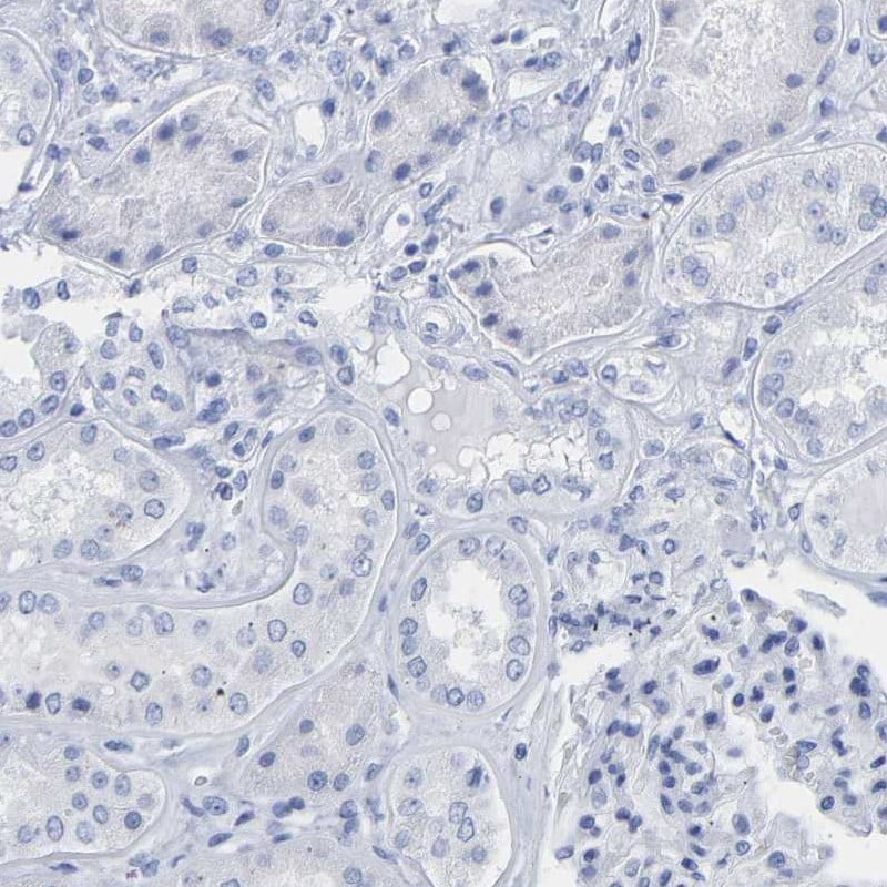 Cytokeratin 1 Antibody - BSA Free Immunohistochemistry: Cytokeratin 1 Antibody - BSA Free [NBP1-87956]