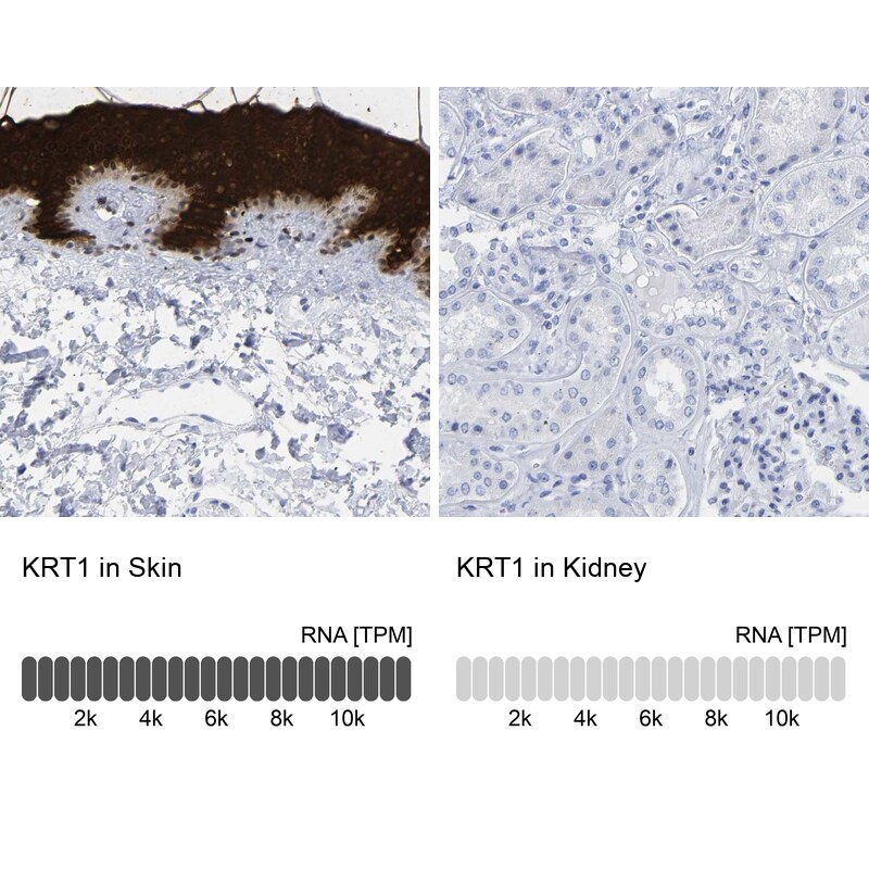 Cytokeratin 1 Antibody - BSA Free Immunohistochemistry: Cytokeratin 1 Antibody - BSA Free [NBP1-87956]