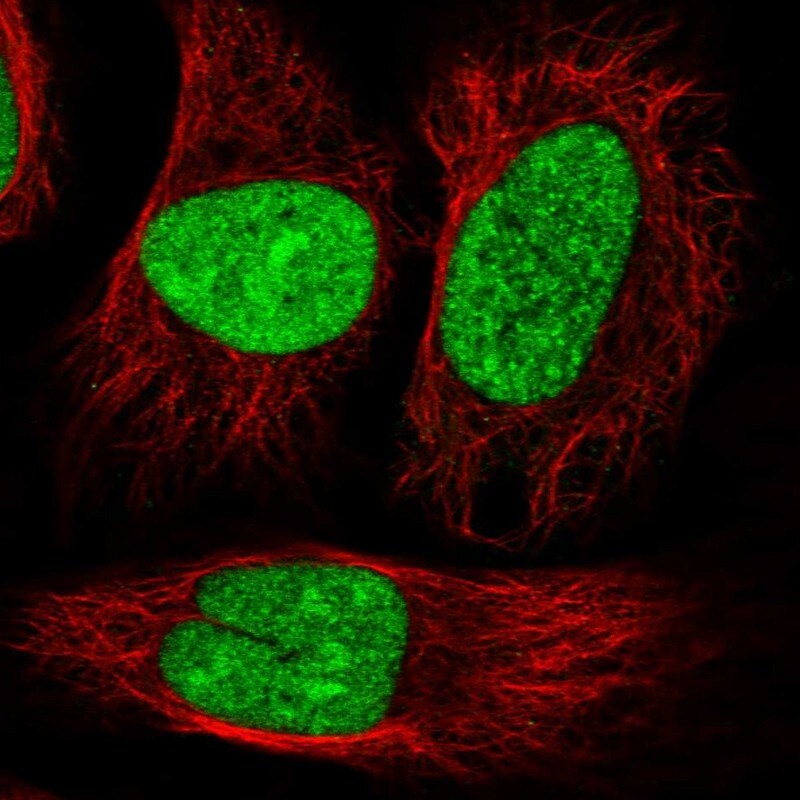 DRB1 Antibody - BSA Free Immunocytochemistry/ Immunofluorescence: DRB1 Antibody - BSA Free [NBP1-87966]