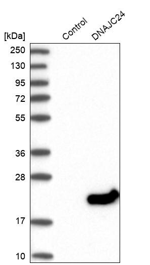 DPH4 Antibody - BSA Free Western Blot: DPH4 Antibody - BSA Free [NBP1-87968]