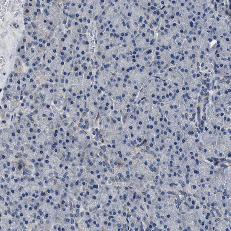 DPH4 Antibody - BSA Free Immunohistochemistry-Paraffin: DPH4 Antibody - BSA Free [NBP1-87969]