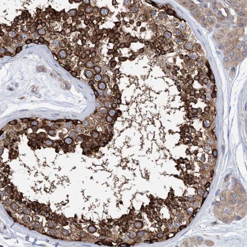 DYNC1LI1 Antibody - BSA Free Immunohistochemistry-Paraffin: DYNC1LI1 Antibody - BSA Free [NBP1-87972]