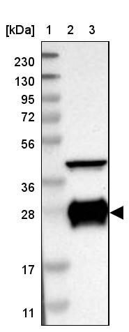 CSP Antibody - BSA Free Western Blot: CSP Antibody - BSA Free [NBP1-87974]