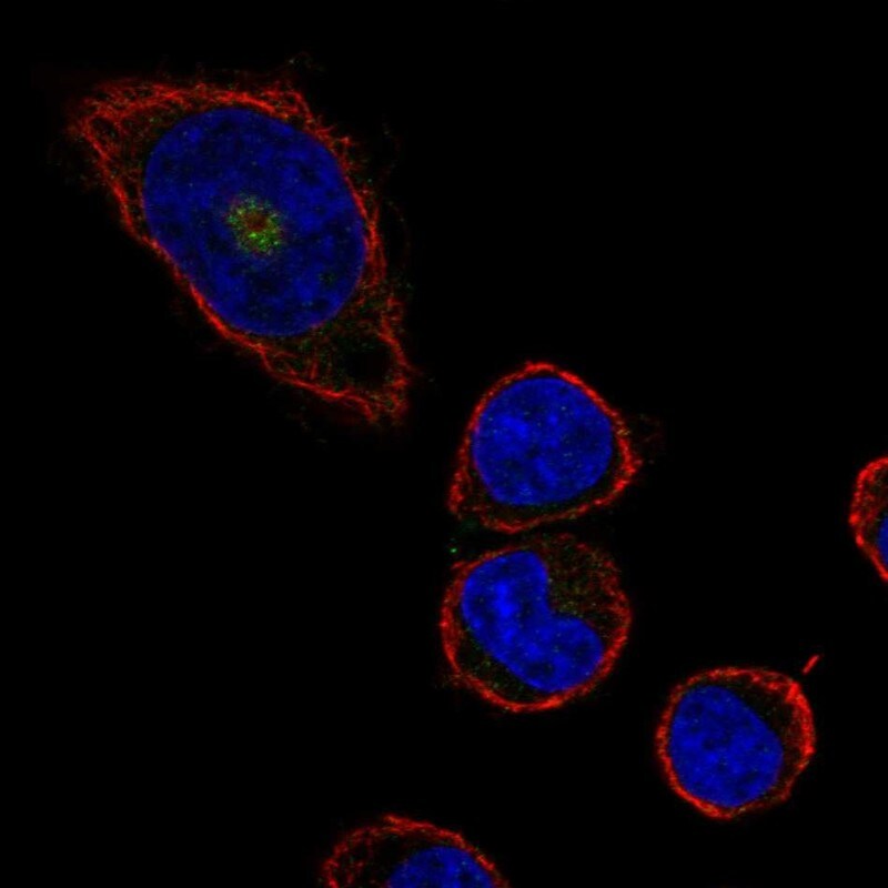 CD36 Antibody Immunocytochemistry/ Immunofluorescence: CD36 Antibody [NBP1-83922]