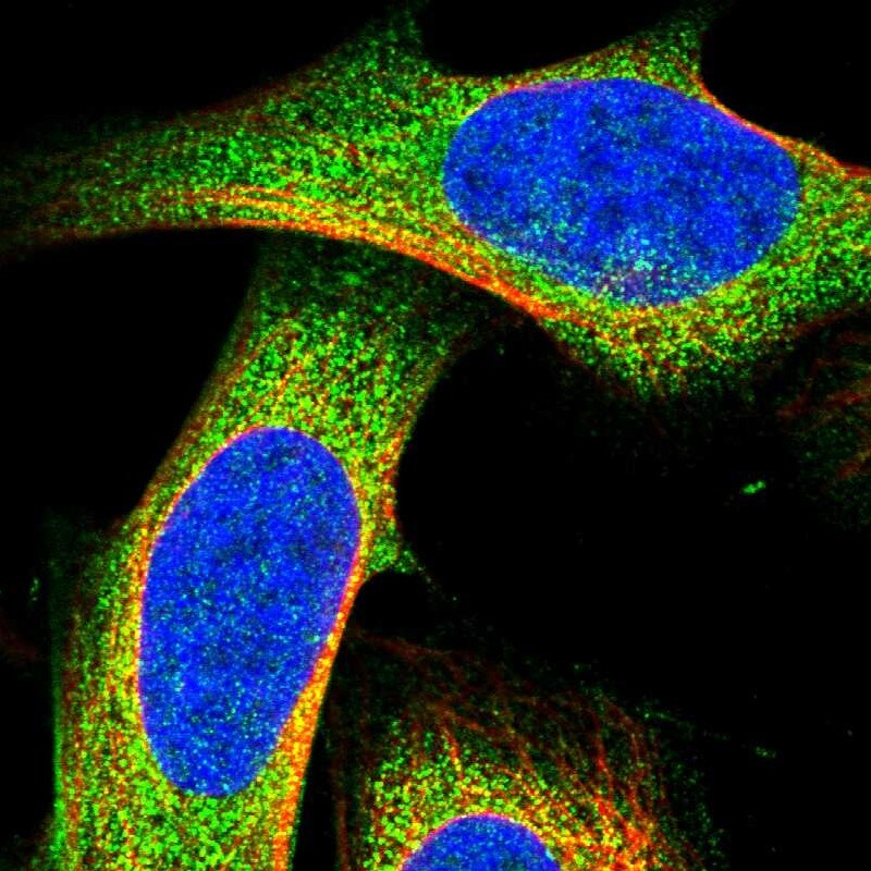 DLC1/DLEC1 Antibody Immunocytochemistry/ Immunofluorescence: DLC1/DLEC1 Antibody [NBP1-87977]