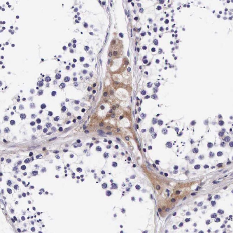 FUR1 Antibody - BSA Free Immunohistochemistry-Paraffin: FUR1 Antibody - BSA Free [NBP1-87979]