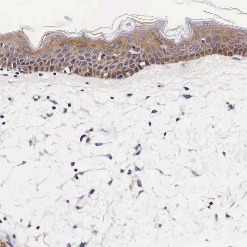 FUR1 Antibody - BSA Free Immunohistochemistry-Paraffin: FUR1 Antibody - BSA Free [NBP1-87979]