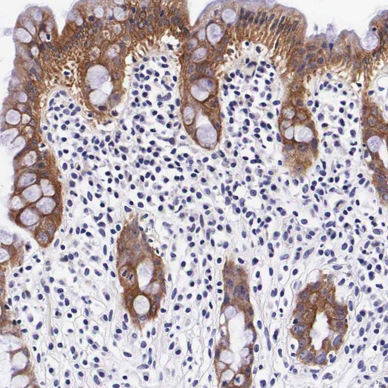 FUR1 Antibody - BSA Free Immunohistochemistry-Paraffin: FUR1 Antibody - BSA Free [NBP1-87979]
