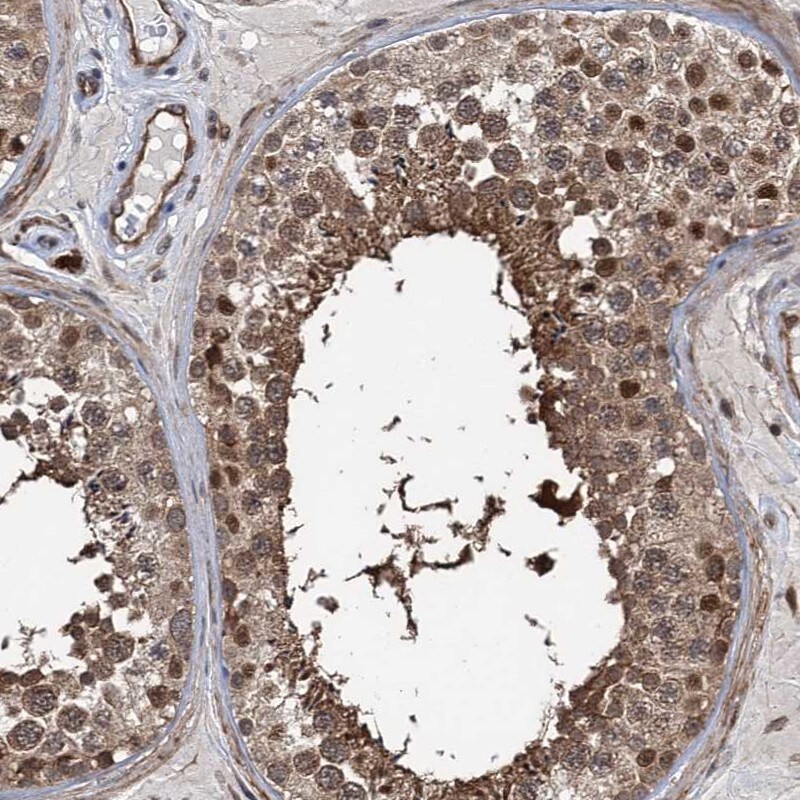 GPBP Antibody - BSA Free Immunohistochemistry-Paraffin: GPBP Antibody [NBP1-87980]