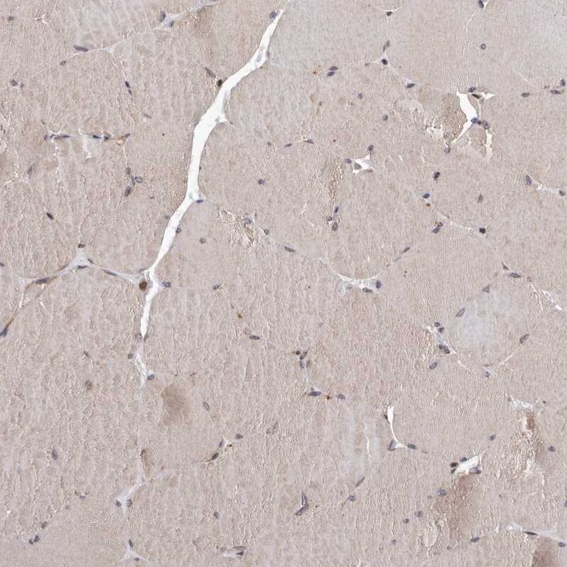 MYD118 Antibody - BSA Free Immunohistochemistry-Paraffin: MYD118 Antibody [NBP1-87990]