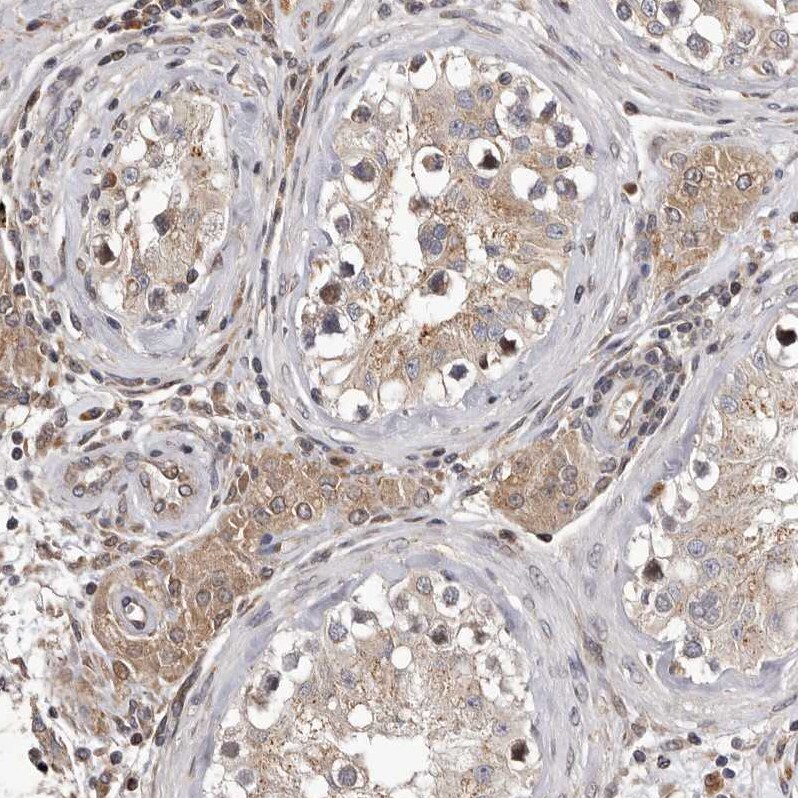 MYD118 Antibody - BSA Free Immunohistochemistry-Paraffin: MYD118 Antibody [NBP1-87990]