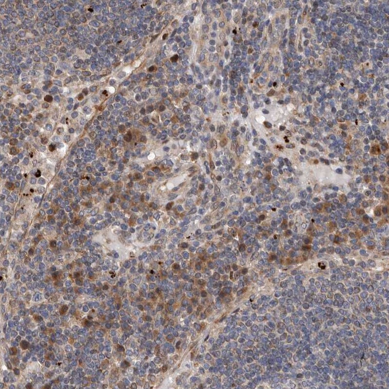 MYD118 Antibody - BSA Free Immunohistochemistry-Paraffin: MYD118 Antibody [NBP1-87990]