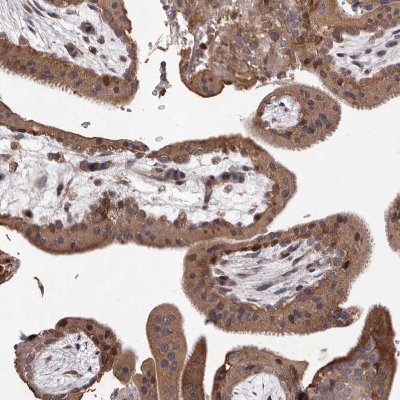 MYD118 Antibody - BSA Free Immunohistochemistry-Paraffin: MYD118 Antibody [NBP1-87990]
