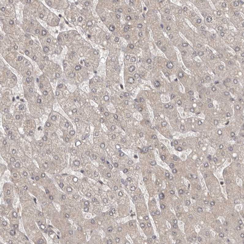 QRSL Antibody - BSA Free Immunohistochemistry-Paraffin: QRSL Antibody - BSA Free [NBP1-87991]