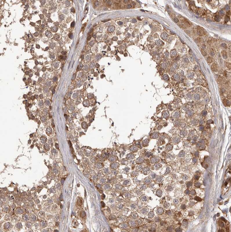 QRSL Antibody - BSA Free Immunohistochemistry-Paraffin: QRSL Antibody - BSA Free [NBP1-87991]