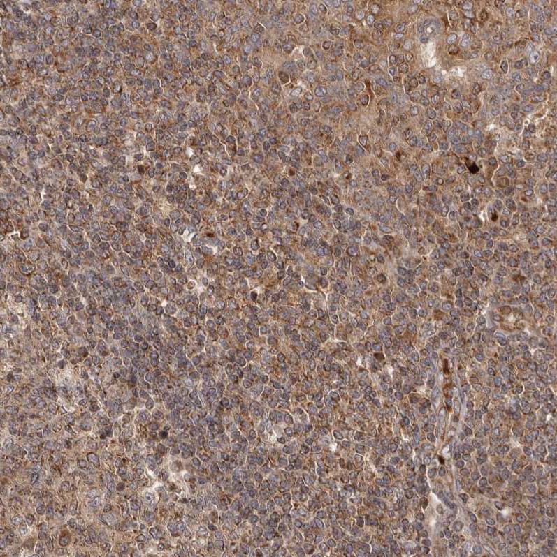 QRSL Antibody - BSA Free Immunohistochemistry-Paraffin: QRSL Antibody - BSA Free [NBP1-87991]