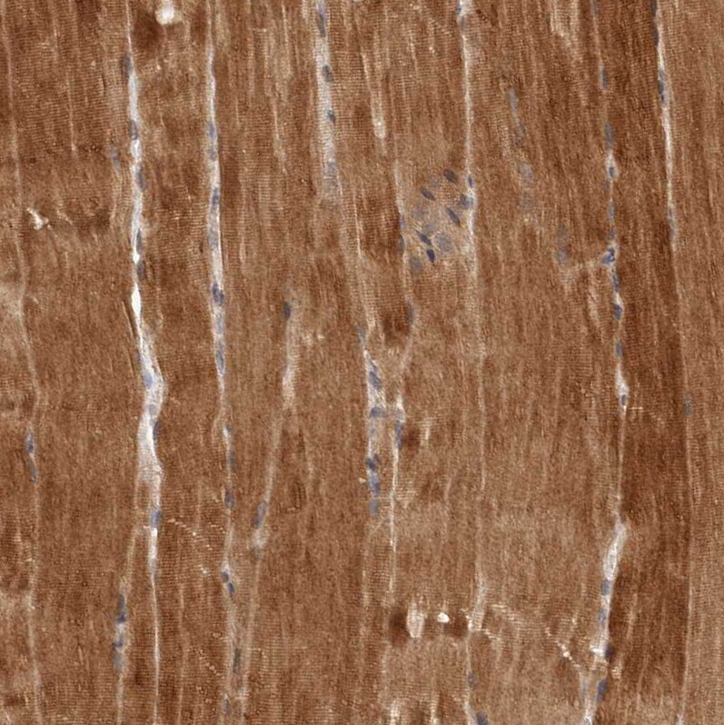 QRSL Antibody - BSA Free Immunohistochemistry-Paraffin: QRSL Antibody - BSA Free [NBP1-87991]