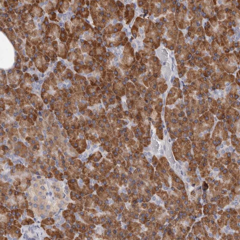 QRSL Antibody - BSA Free Immunohistochemistry-Paraffin: QRSL Antibody [NBP1-87992]