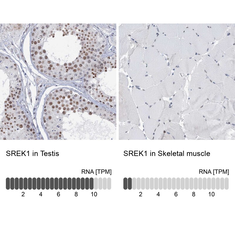SFRS12 Antibody - BSA Free Immunohistochemistry-Paraffin: SFRS12 Antibody [NBP1-87993]