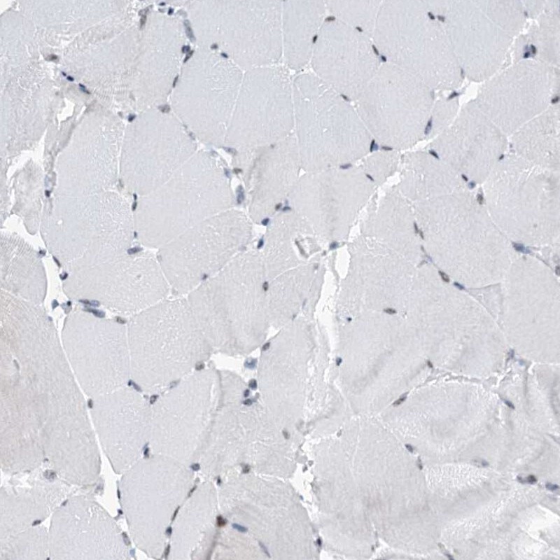 SFRS12 Antibody - BSA Free Immunohistochemistry-Paraffin: SFRS12 Antibody [NBP1-87993]