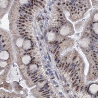 SFRS12 Antibody - BSA Free Immunohistochemistry-Paraffin: SFRS12 Antibody [NBP1-87993]