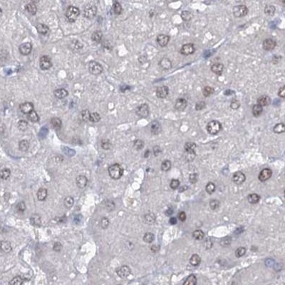 SFRS12 Antibody - BSA Free Immunohistochemistry-Paraffin: SFRS12 Antibody [NBP1-87993]