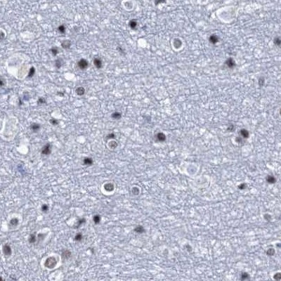 SFRS12 Antibody - BSA Free Immunohistochemistry-Paraffin: SFRS12 Antibody [NBP1-87993]
