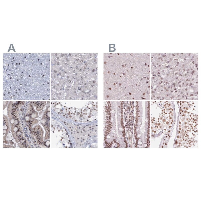 SFRS12 Antibody - BSA Free Immunohistochemistry-Paraffin: SFRS12 Antibody [NBP1-87993]