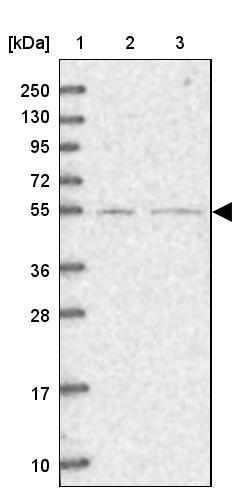SFRS12 Antibody - BSA Free Western Blot: SFRS12 Antibody - BSA Free [NBP1-87993]