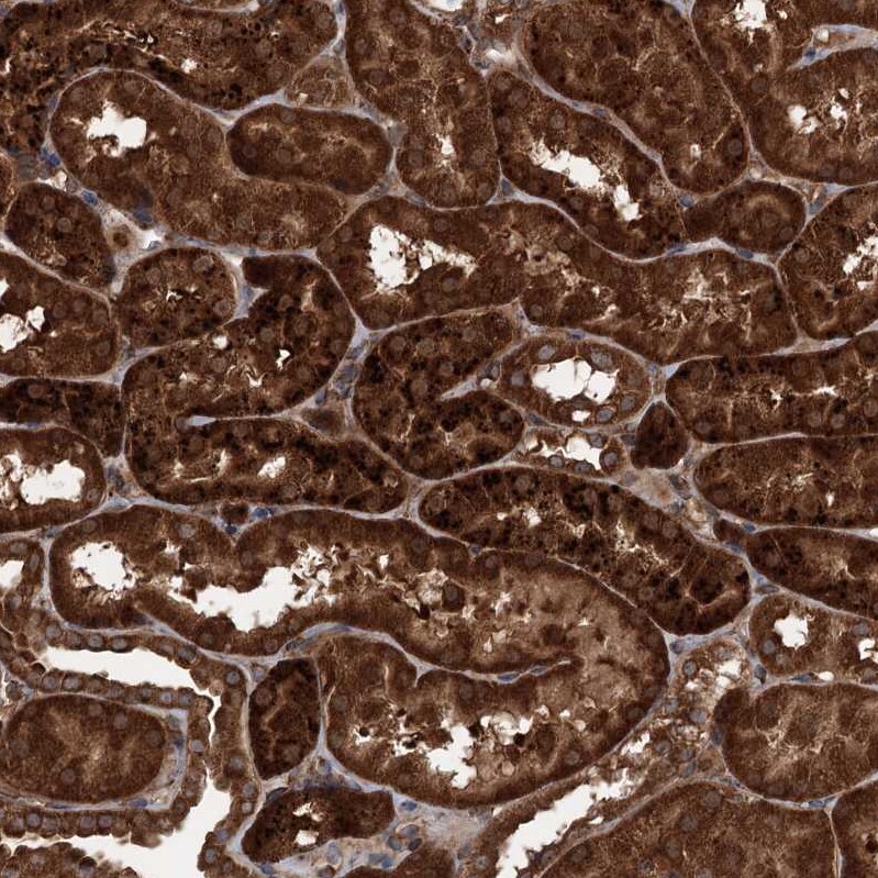 Ring finger protein 214 Antibody - BSA Free Immunohistochemistry-Paraffin: Ring finger protein 214 Antibody - BSA Free [NBP1-87994]