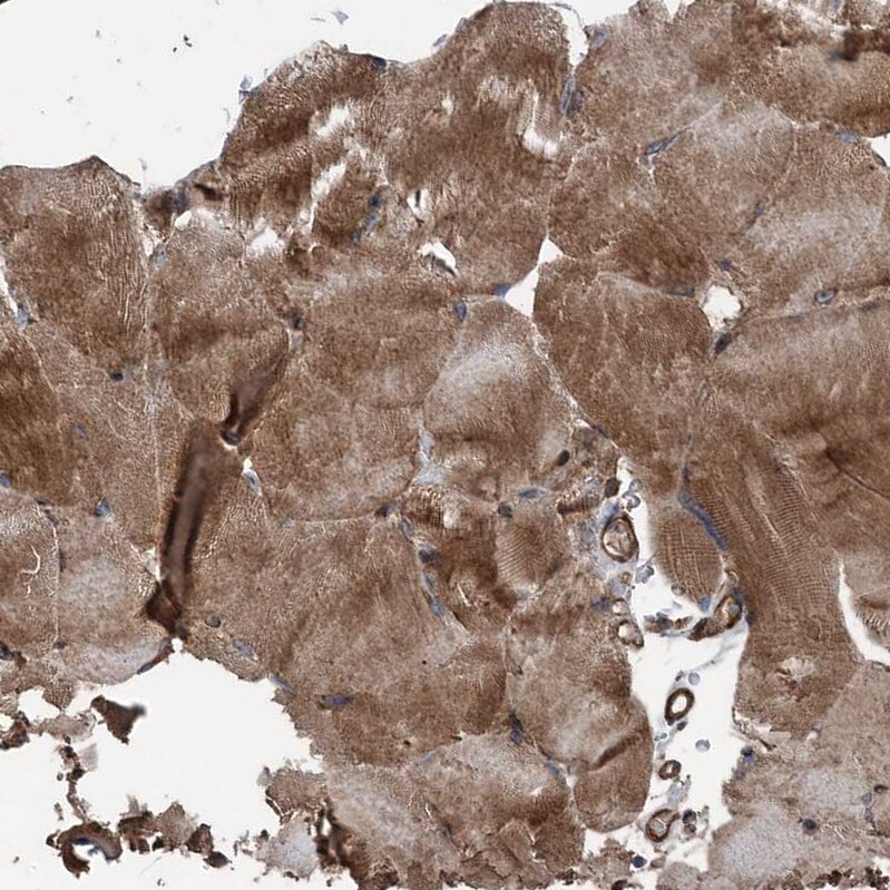 Ring finger protein 214 Antibody - BSA Free Immunohistochemistry-Paraffin: Ring finger protein 214 Antibody - BSA Free [NBP1-87994]