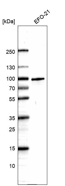 Ring finger protein 214 Antibody - BSA Free Western Blot: Ring finger protein 214 Antibody - BSA Free [NBP1-87994]