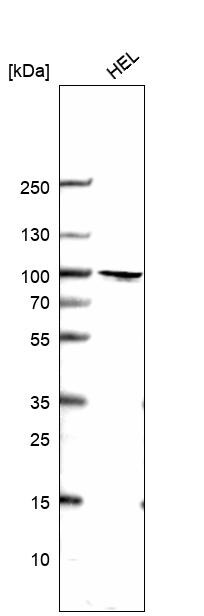 Ring finger protein 214 Antibody - BSA Free Western Blot: Ring finger protein 214 Antibody - BSA Free [NBP1-87994]