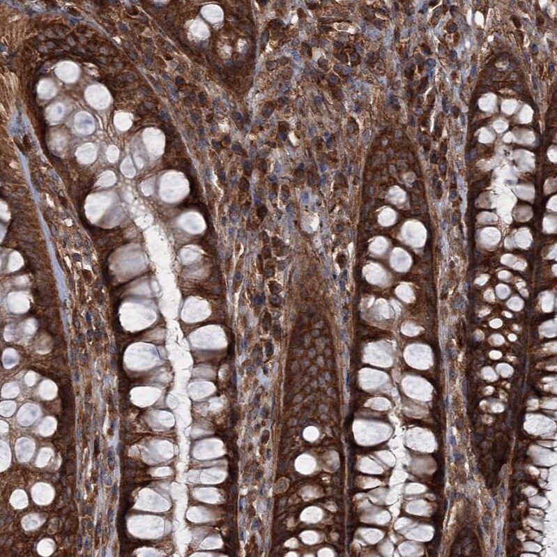 Ring finger protein 214 Antibody - BSA Free Immunohistochemistry-Paraffin: Ring finger protein 214 Antibody - BSA Free [NBP1-87994]