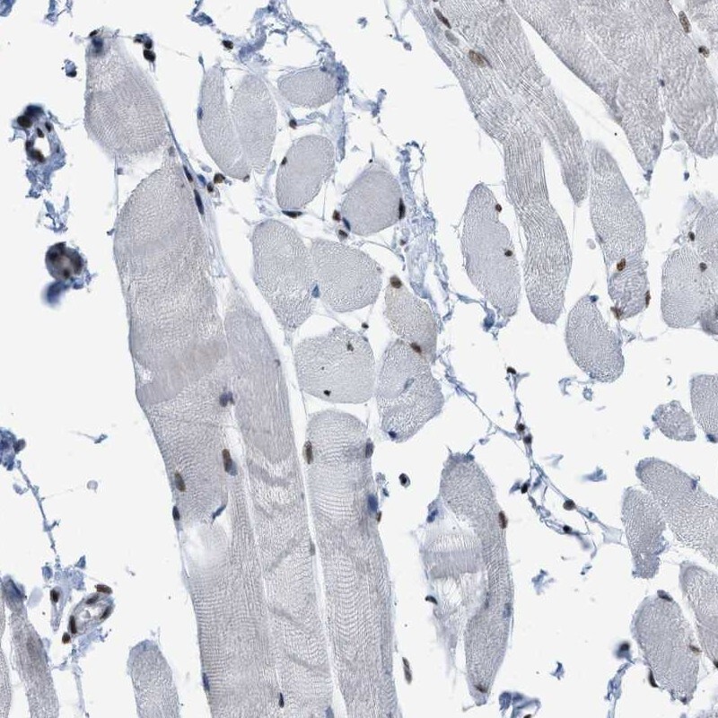 SFRS15 Antibody - BSA Free Immunohistochemistry-Paraffin: SFRS15 Antibody [NBP1-88002]