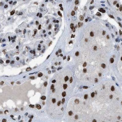 SFRS15 Antibody - BSA Free Immunohistochemistry-Paraffin: SFRS15 Antibody [NBP1-88002]